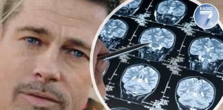 Brad Pitt Prosopagnosia